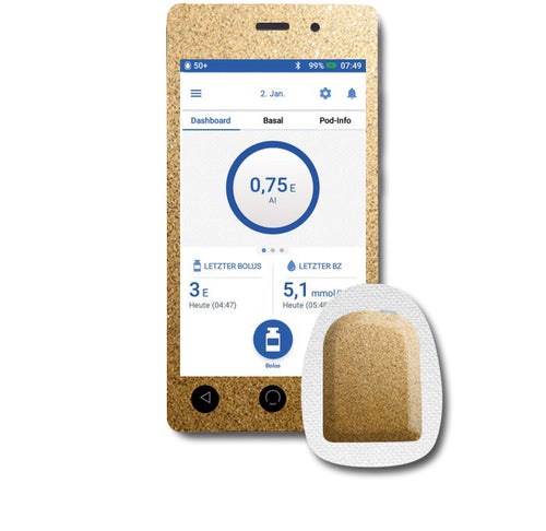 Omnipod DASH Sticker Set "Glitzer Gold"