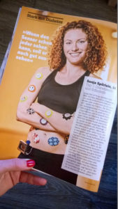 Página de artículo en Focus Diabetes con Sonja Spörlein y stickers en la piel